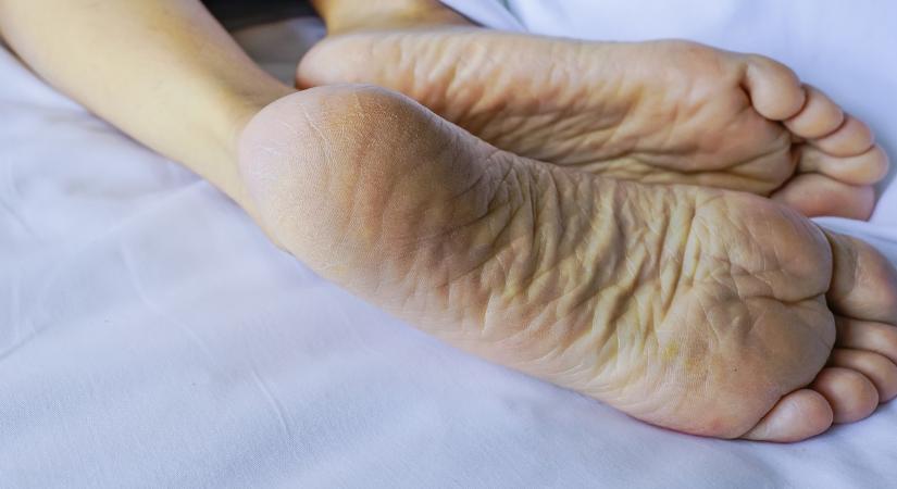 A puha sarkak titka: Egy recept egyetlen hozzávalóval, ami a konyhádban is megtalálható