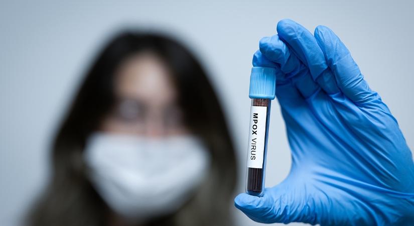 Megint világjárvány fenyeget: terjed a himlőmutáns az európai fesztiválokon
