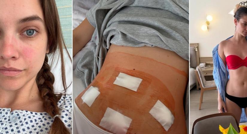 Nők ezreinek adhat erőt Palvin Barbara posztja – endometriózissal műtötték a modellt