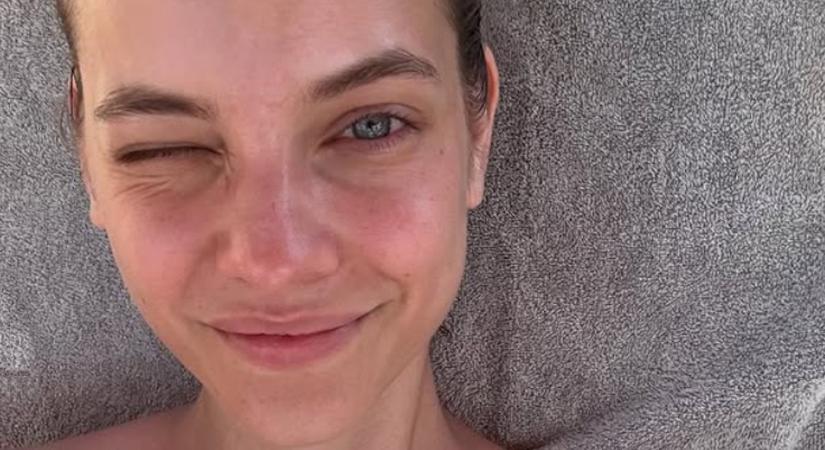 Palvin Barbara már egész éjszakákat nem aludt a fájdalomtól: kiderült, mi okozza a súlyos tüneteket