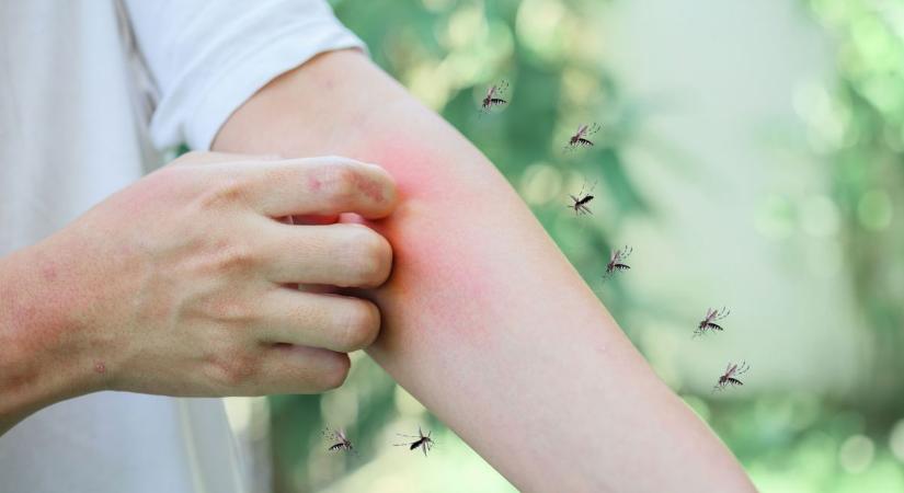 Viszketés, duzzanat, pánik nélkül – nyári túlélőkalauz rovarcsípésekhez