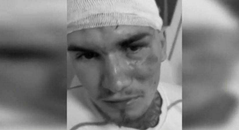 Összeverték Richárdot a borsodi házibulin, megdöbbentő, mit állít a házigazda – videóval