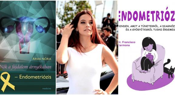 „Ezzel küzdök. Szar ügy. Beszéljünk róla!” – 3 könyv az endometriózisról