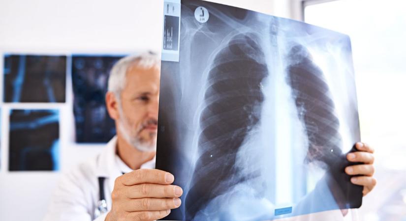 Mi a különbség a röntgen, a CT , az ultrahang és az MRI között?
