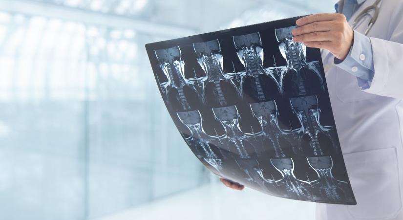 Életmentő vizsgálatok: mit tud a röntgen, a CT, az MRI és az ultrahang?