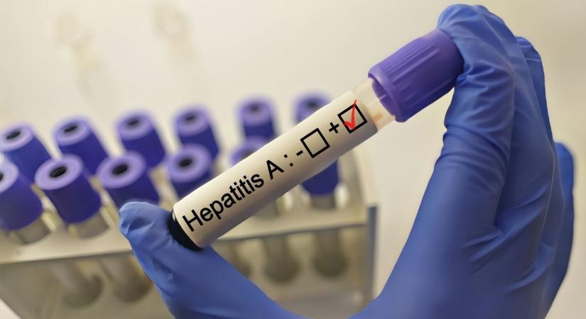 Hepatitis-A fertőzések miatt le kellett fújni az augusztus 20-i ünnepségeket ebben a kisvárosban