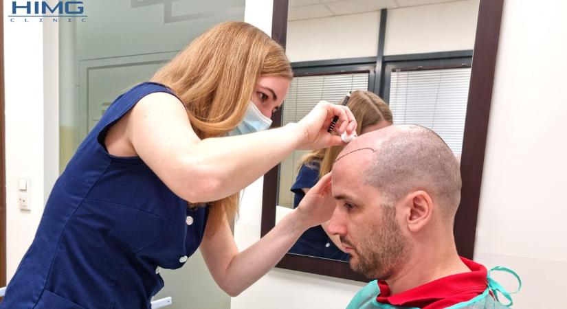 Hajbeültetés Szeged – Miért éri meg Budapestre utazni a HIMG Klinikára?