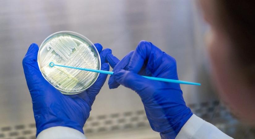 Ezért lehet aggasztó a Pseudomonas aeruginosa baktérium kórházi felbukkanása