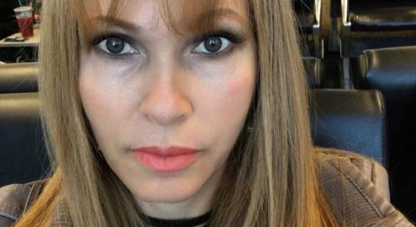 Járni, beszélni sem tud: a fenékplasztika tette tönkre ennek a nőnek az életét - Fotók