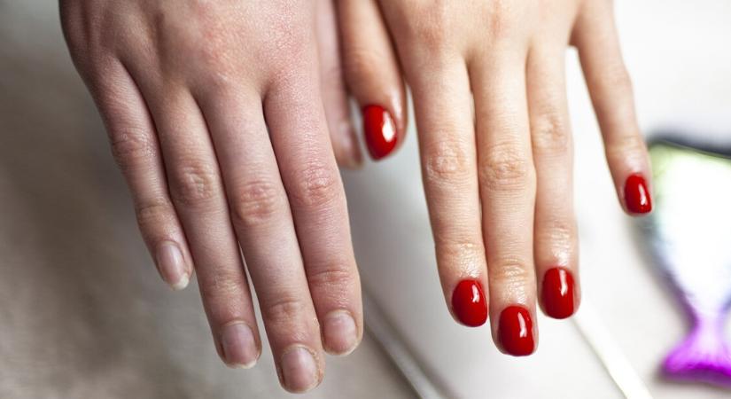 Géllakk: zöld köröm szindrómát is okozhat – Mutatjuk, mire figyelj