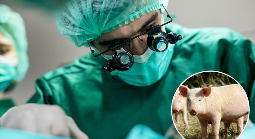 Először lélegzett módosított sertéstüdővel egy ember