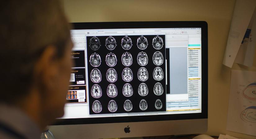 A tudomány is alátámasztja: ez a diéta csökkentheti az Alzheimer-kór kockázatát