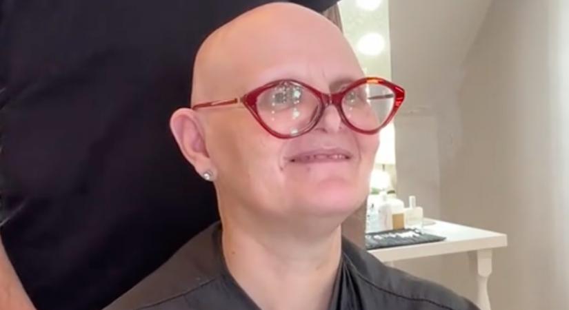 Dús hajra vágyik a kopasz nő: az új frizurája nem csak őt sokkolja - Videó