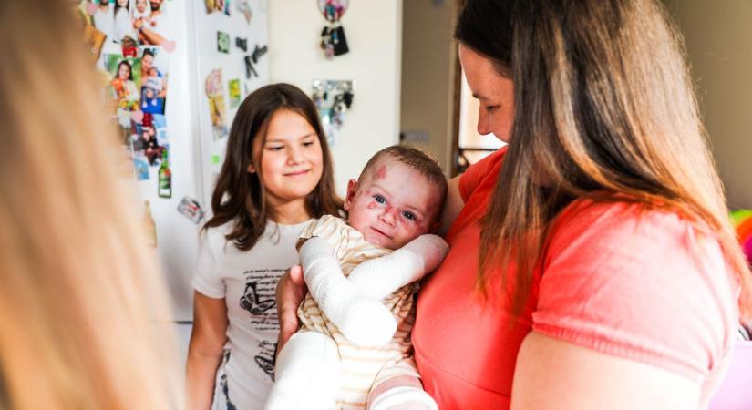 „Egy ölelés is sebet okozhat a testén” – a kis Soma fájdalmai ellenére is mosolyogva hódítja meg a világot