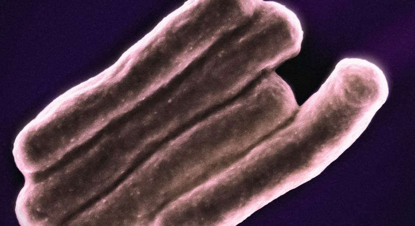 Belgiumban többen meghaltak toxint termelő E. coli baktérium okozta fertőzés következtében