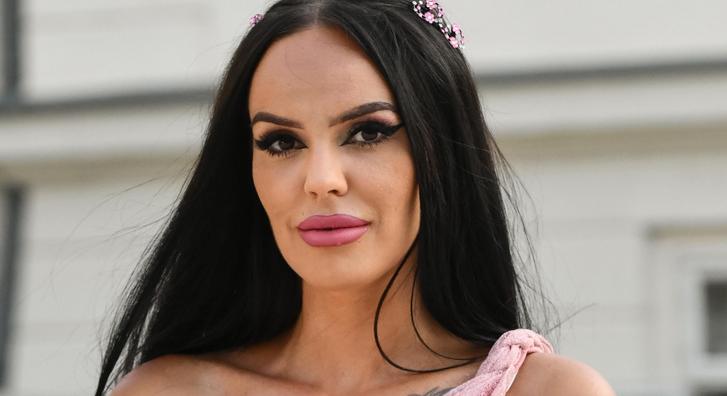 Elrontották a Házasság első látásra Renijének szépészeti beavatkozását: „400 ezer forintot fizettem, hogy felismerhetetlen legyek”