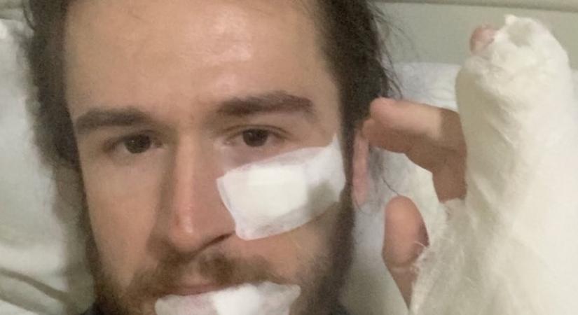 Tüntetésen sérült meg a lapunkat is rendszeresen tudósító magyar Tbilisziben