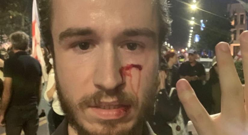 Brutálisan összeverték a Magyar Hang újságíróját, Mézes László Róbertet (Videóval!)
