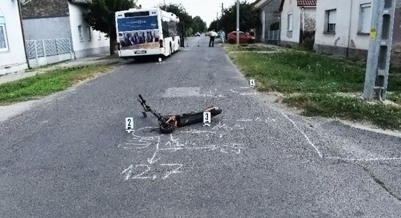E-rollerbalesetek: naponta 5 gyerek kerül a sürgősségire csak Budapesten