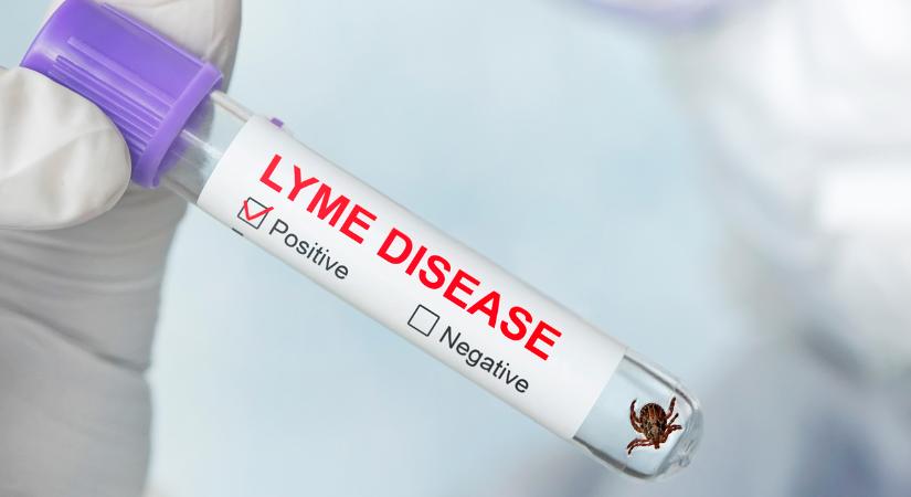 Miért alakul ki a kimerültség Lyme-kórban?