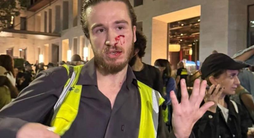 Reagált a külügy a georgiai tüntetésen megvert magyar tudósító ügyére