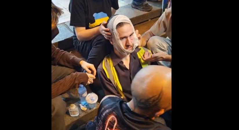 Felajánlotta segítségét a külügy a Tbilisziben megvert magyar tudósítónak, de a támadást nem ítélte el