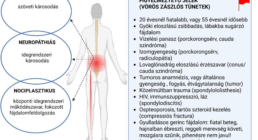 A derékfájás neuropáthiás vonatkozásai