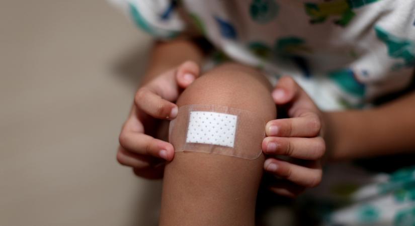 Sebkezelés otthon: ezeket a lépéseket kövesd – Íme a tünetek, amelyekkel azonnal irány az orvos