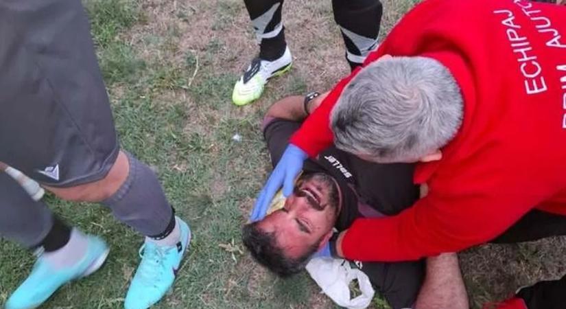 Kegyetlen: Torkánál fogva szorították és brutálisan megverték a román bírót - fotó