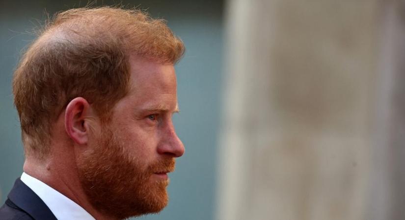 Kiderült, mikkel küzd Harry herceg a hajhullás ellen