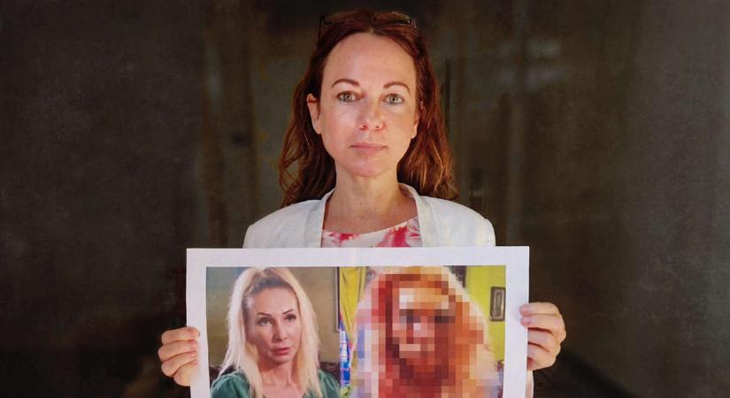 Megvonták a fizetését, amiért Orosz Bernadett sérüléseivel szemléltette a kapcsolati erőszakról szóló javaslatát Szabó Tímea
