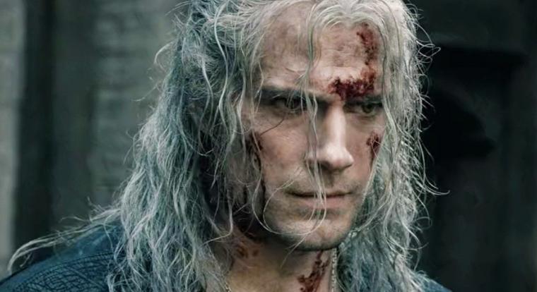 Henry Cavill képekkel és verssel üzent a sérülése miatt aggódó rajongóknak