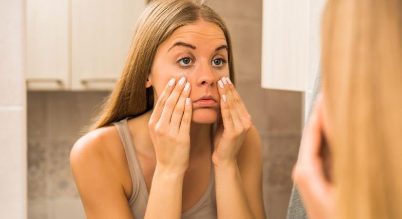 Ezért ébredünk puffadt arccal – és így előzhetjük meg