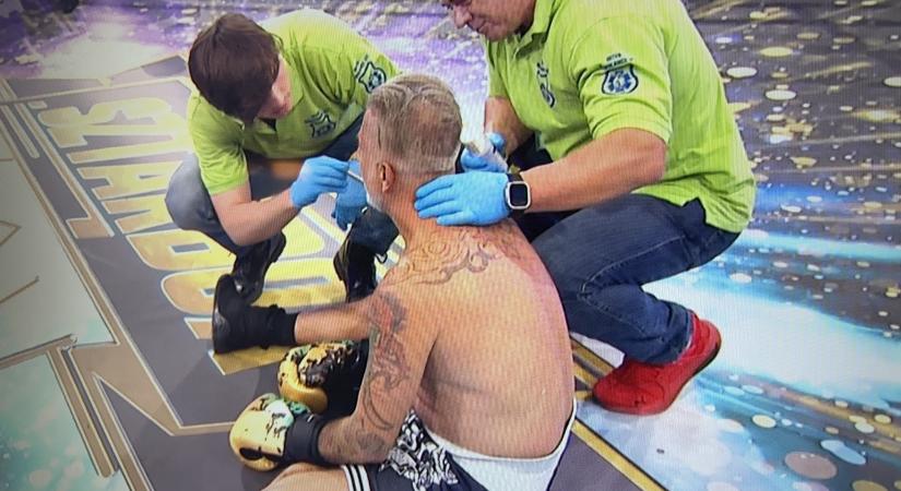 Csúnyán kiütötték a Hooligans énekesét a Sztárboxban