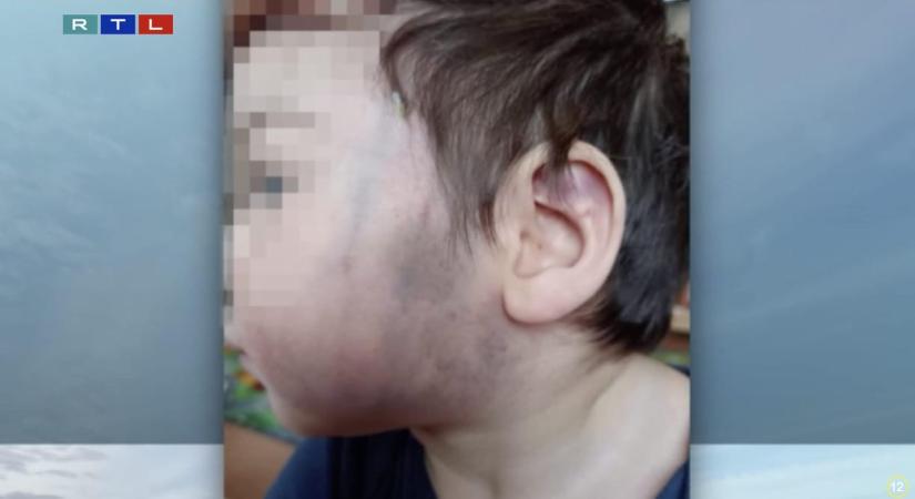 Súlyosan bántalmazhattak egy másfél éves kisfiút a szekszárdi gyermekotthonban