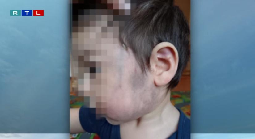 Súlyoson bántalmazhattak egy másfél éves kisfiút a szekszárdi befogadó otthon csecsemő részlegén
