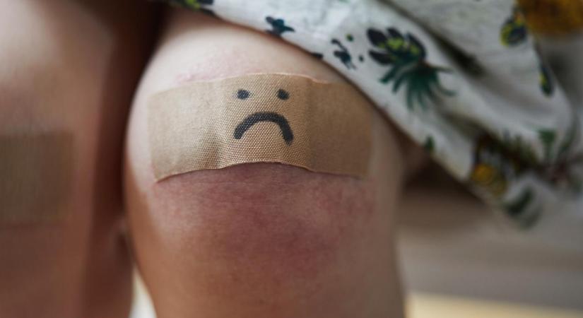 Megduzzadt arccal került elő a másfél éves Noel – gyermekotthonban történhetett a bántalmazás