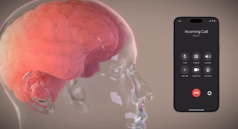 Napokon belül indul a kísérlet: írott szöveggé alakíthatja a gondolatokat a Neuralink agyi chipje