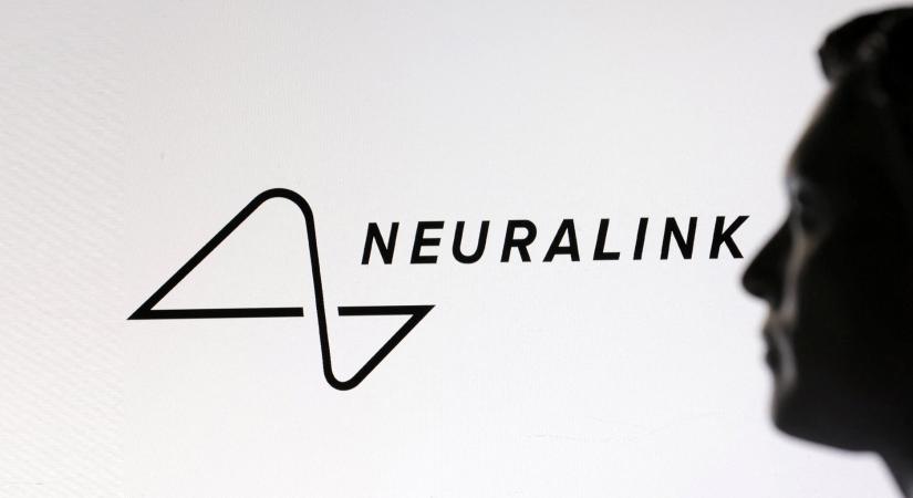 Gondolatot olvasna Elon Musk új Neuralink chipje