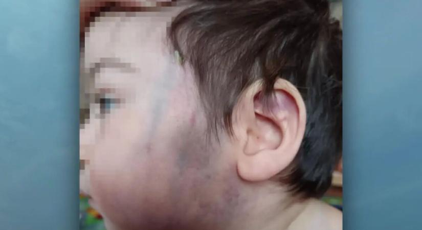 Nevelő bántalmazhatott egy gyereket a szekszárdi gyermekotthonban