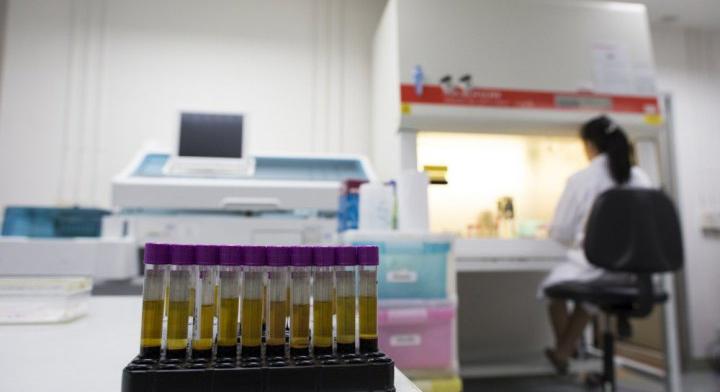 Az ENSZ a finanszírozás csökkentése miatt a UNAIDS 2026-os bezárását javasolja