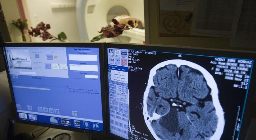Természetes gyógymód jöhet a stroke ellen