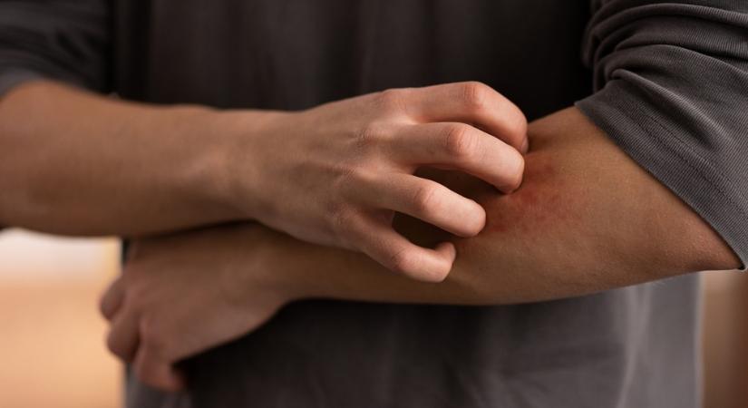 Vakard vagy ne vakard? – Az örök dilemma