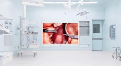 Tűéles 4K a műtőben: Az LG bemutatja új sebészeti monitorát