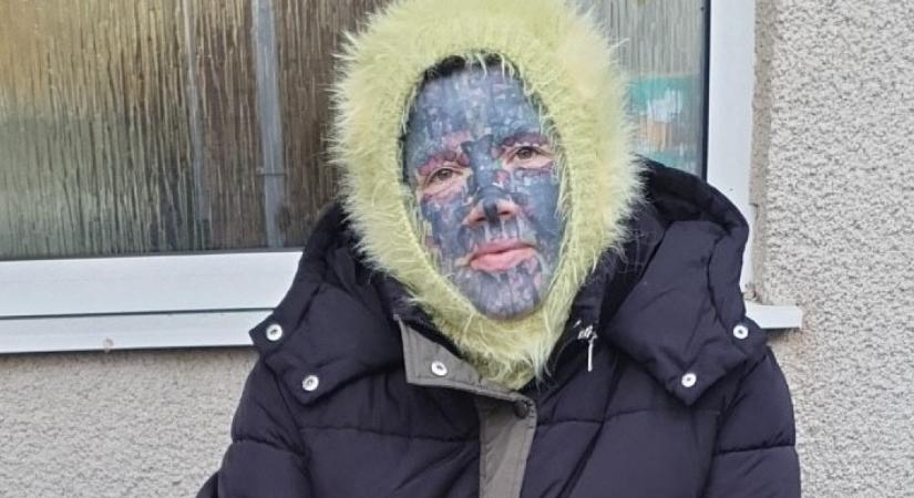 Leszedték az anya arctetkóit: sokkot kaptak a gyerekei, amikor meglátták - Fotók