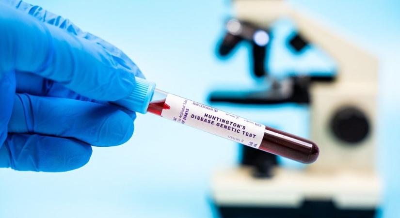 Áttörést érhettek el a Huntington-kór kezelésében