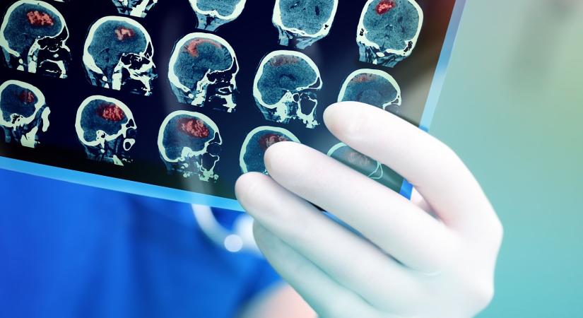Évente 250-300 újonnan diagnosztizált rákos gyerek van – Sárga tengeralattjárós MR kellene
