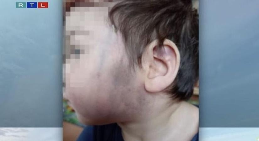 Nyomozás indult a szekszárdi befogadó otthonban megsérült kisfiú ügyében