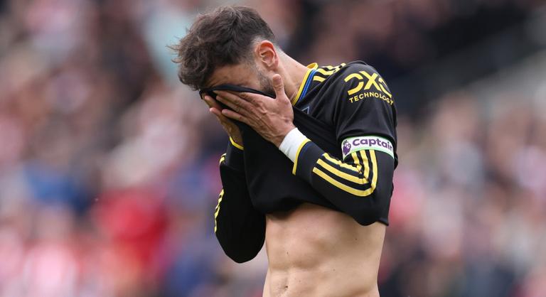 Büntetőt lőhetett az egyenlítésért, de így sem tudta elkerülni a csúnya égést a Manchester United
