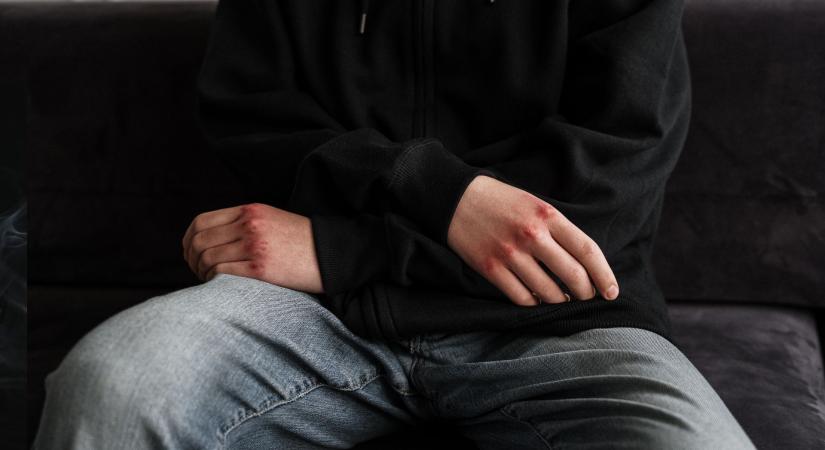 Meg is erőszakolta a cimboráját, nem volt elég a verekedés: férfit erőszakoltak és fosztottak ki Pakson